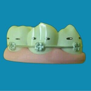 Teeth With Brackets Figurine